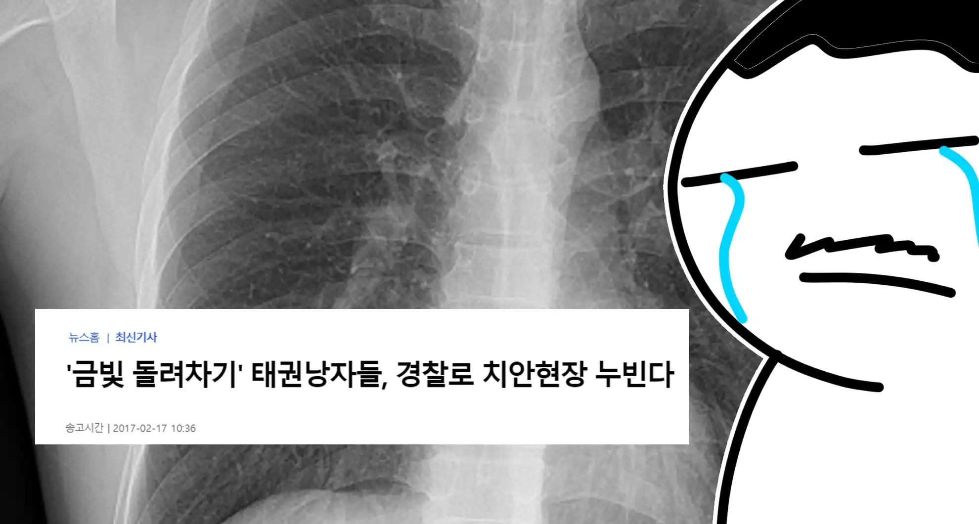 Read more about the article 와이프한테 갈비뼈 맞고 금 간 디씨인을 찾는 디씨인…..소름